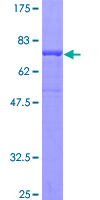 12.5% SDS-PAGE Stained with Coomassie Blue